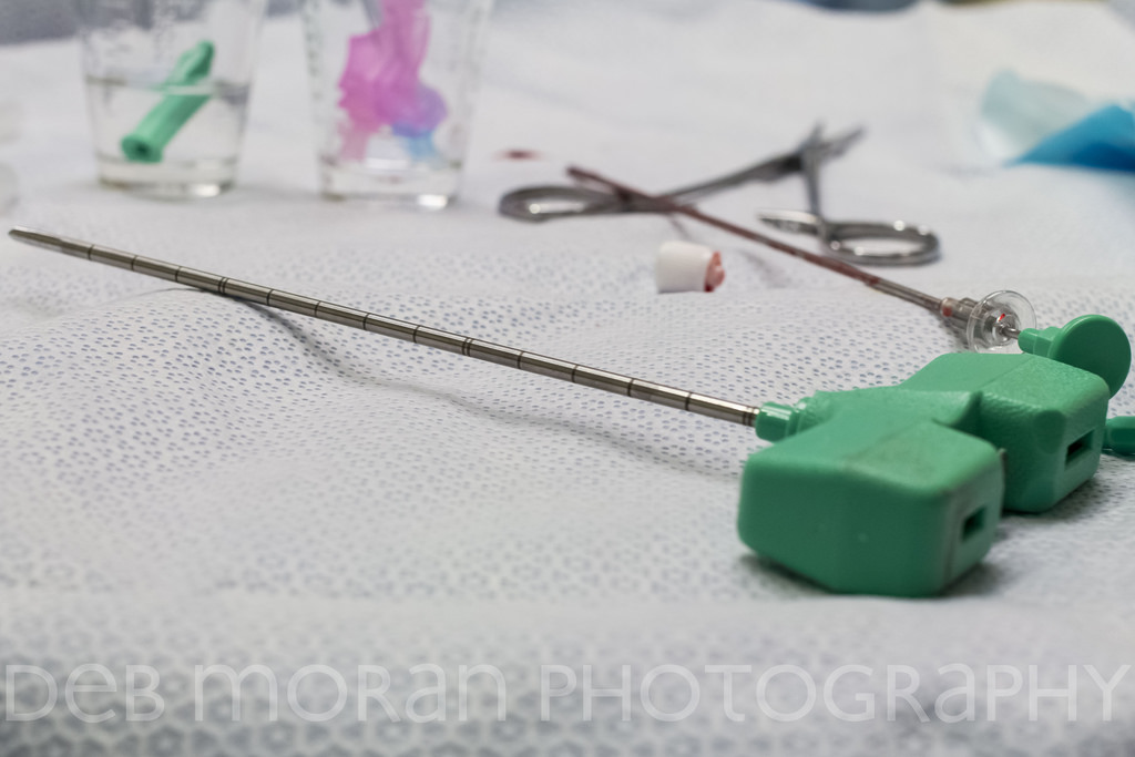 Another Day, Another Biopsy – April 4, 2015
