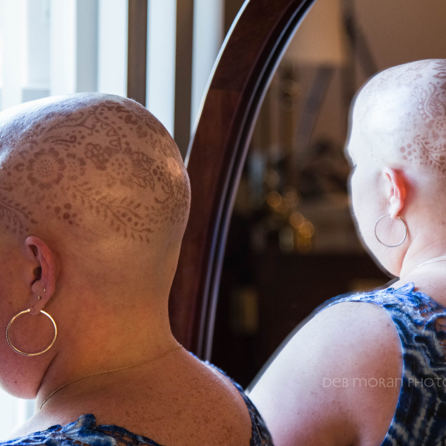 Chemo Head as Art – July 25, 2015