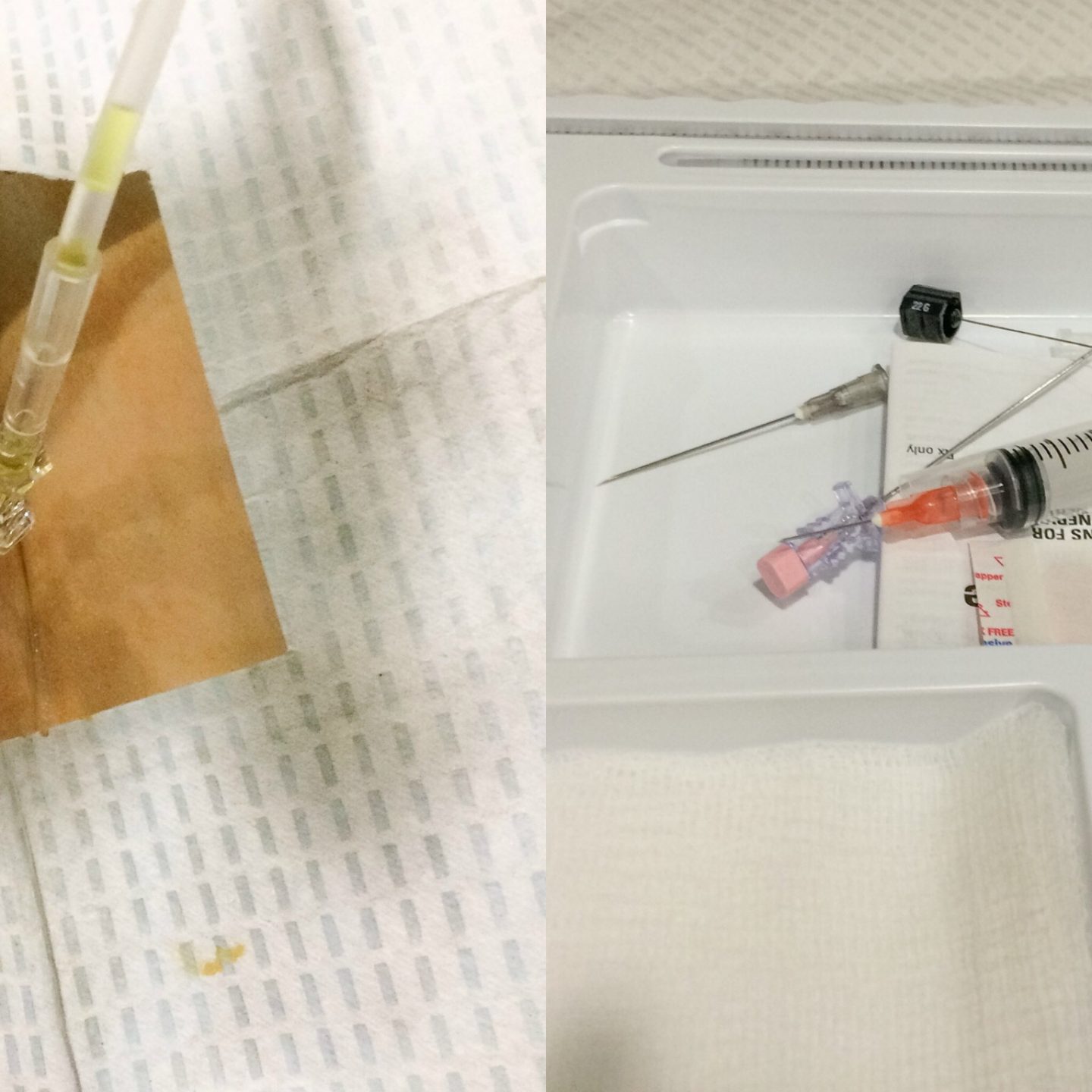 Live from treatment room 6! – July 7, 2015